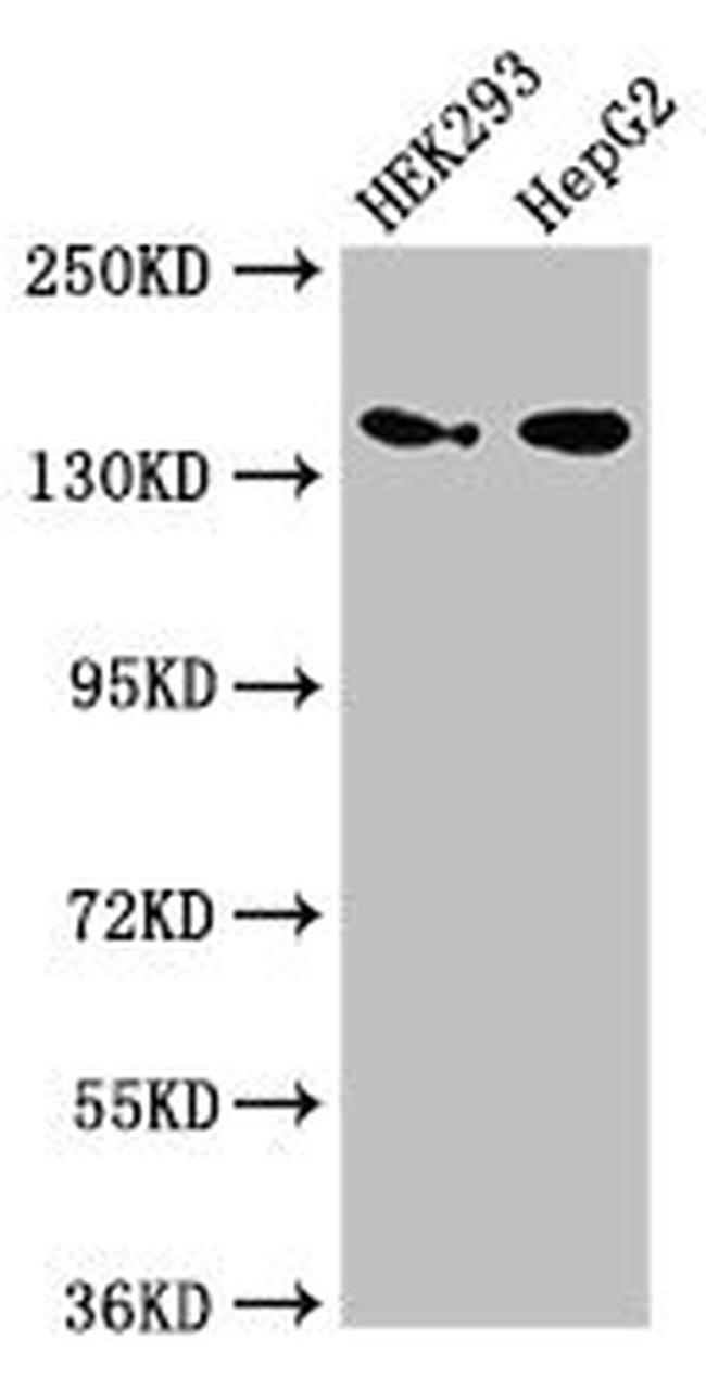 MAN2A1 Antibody in Western Blot (WB)