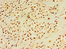 DUSP7 Antibody in Immunohistochemistry (Paraffin) (IHC (P))