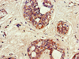 SNX17 Antibody in Immunohistochemistry (Paraffin) (IHC (P))