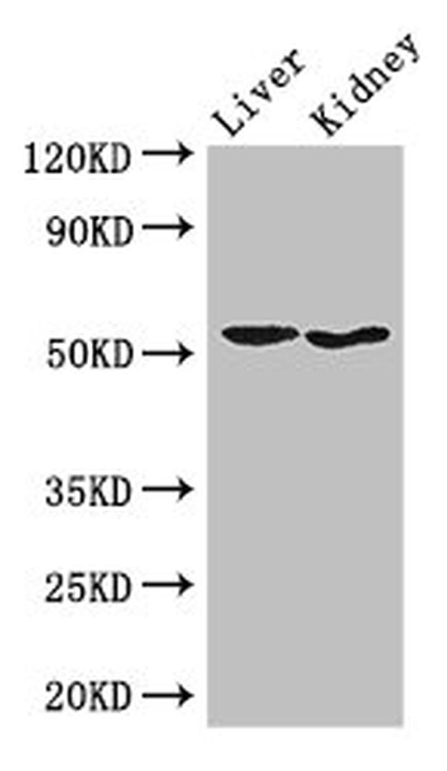 SNX17 Antibody in Western Blot (WB)