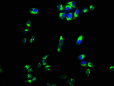 CPEB4 Antibody in Immunocytochemistry (ICC/IF)