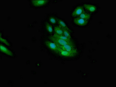 NMI Antibody in Immunocytochemistry (ICC/IF)