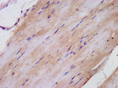 TNIP1 Antibody in Immunohistochemistry (Paraffin) (IHC (P))