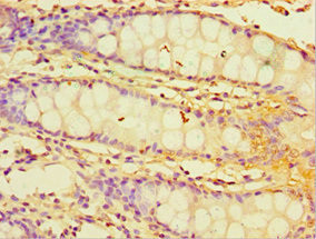 CHI3L2 Antibody in Immunohistochemistry (Paraffin) (IHC (P))