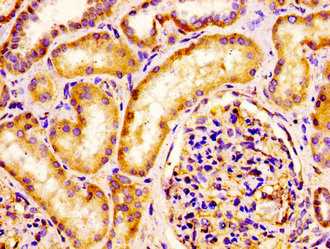 IQCB1 Antibody in Immunohistochemistry (Paraffin) (IHC (P))