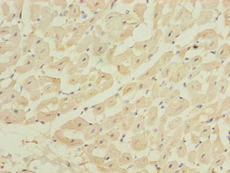 ZBTB6 Antibody in Immunohistochemistry (Paraffin) (IHC (P))