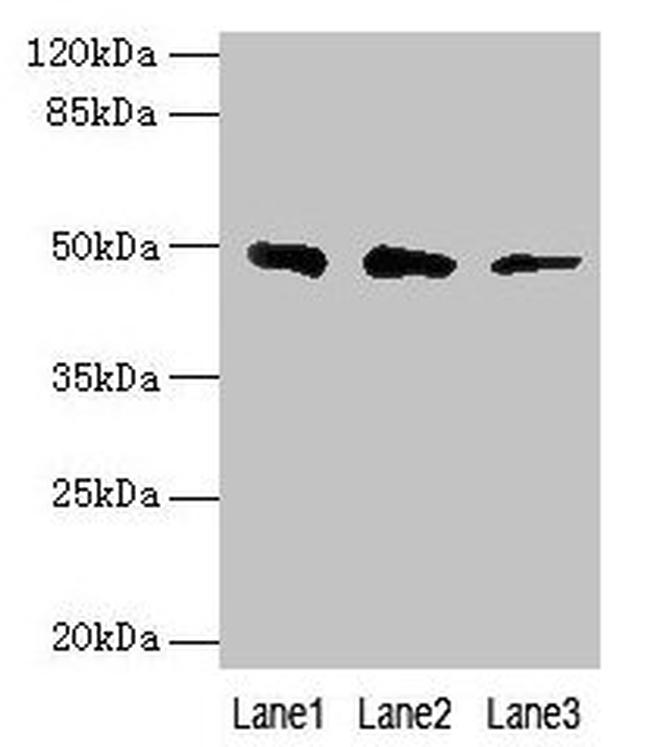 ZBTB6 Antibody in Western Blot (WB)