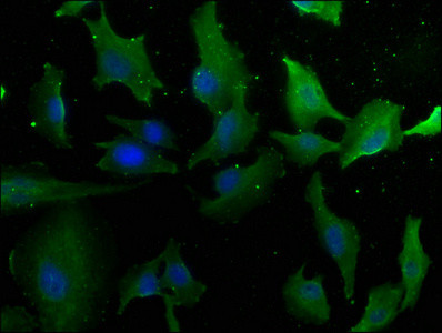 Laminin alpha-4 Antibody in Immunocytochemistry (ICC/IF)