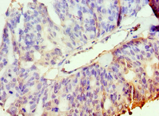 PAK2 Antibody in Immunohistochemistry (Paraffin) (IHC (P))