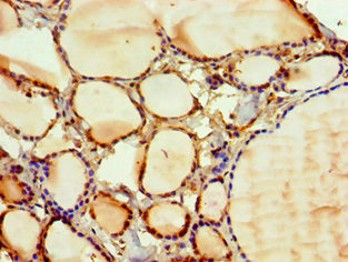 PAK2 Antibody in Immunohistochemistry (Paraffin) (IHC (P))