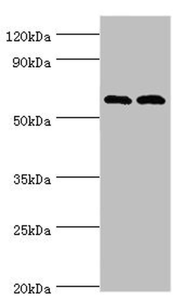 PAK2 Antibody in Western Blot (WB)