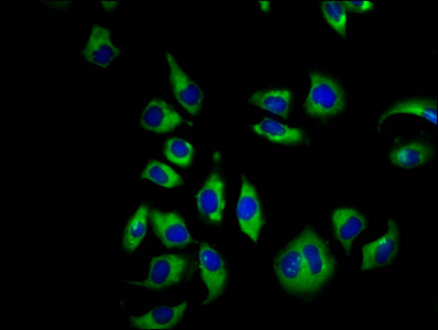 CNGB1 Antibody in Immunocytochemistry (ICC/IF)