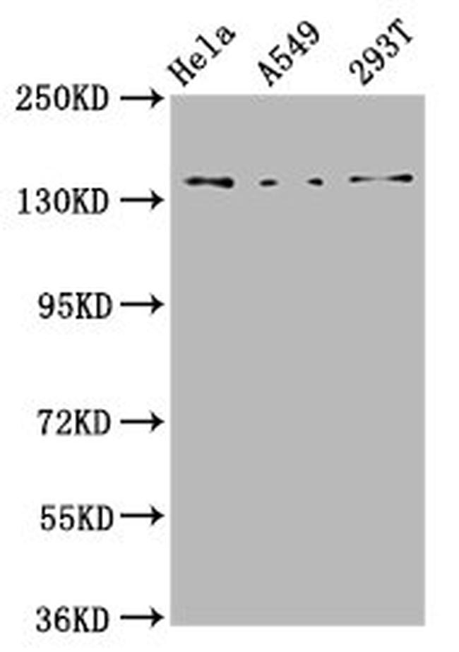 CNGB1 Antibody in Western Blot (WB)