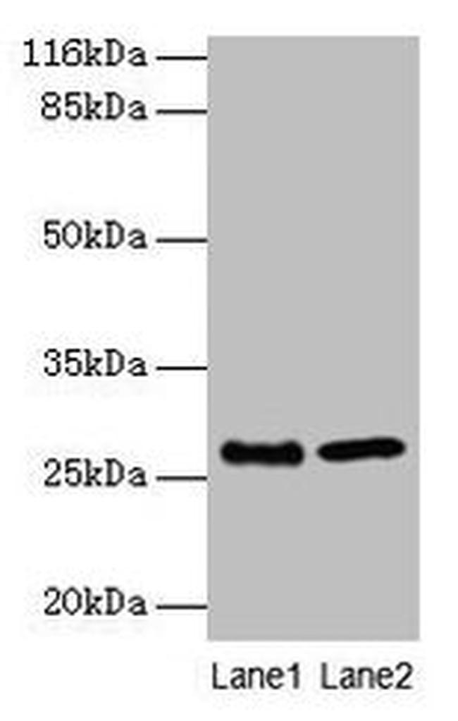 EBP Antibody in Western Blot (WB)