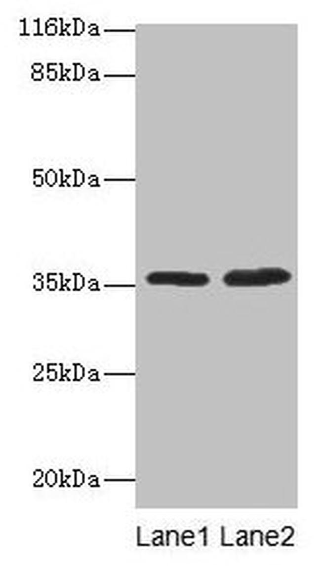 DARC Antibody in Western Blot (WB)