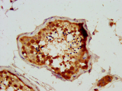 NSUN2 Antibody in Immunohistochemistry (Paraffin) (IHC (P))