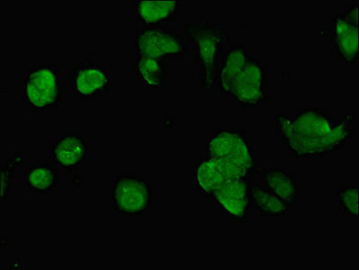 SWI5 Antibody in Immunocytochemistry (ICC/IF)