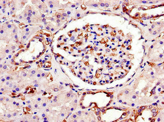 SWI5 Antibody in Immunohistochemistry (Paraffin) (IHC (P))