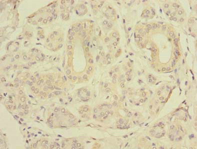 SLC4A8 Antibody in Immunohistochemistry (Paraffin) (IHC (P))