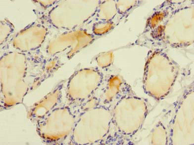 SLC4A8 Antibody in Immunohistochemistry (Paraffin) (IHC (P))