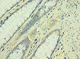 TAF1B Antibody in Immunohistochemistry (Paraffin) (IHC (P))