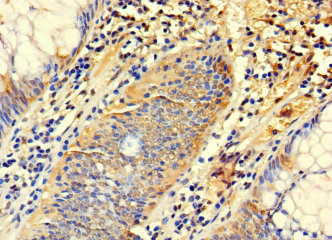 SYTL3 Antibody in Immunohistochemistry (Paraffin) (IHC (P))