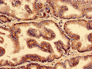 YIF1B Antibody in Immunohistochemistry (Paraffin) (IHC (P))