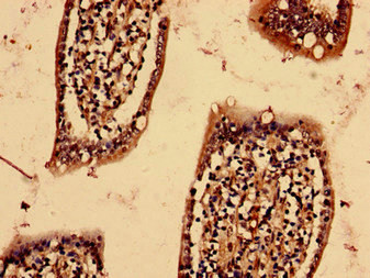 YIF1B Antibody in Immunohistochemistry (Paraffin) (IHC (P))