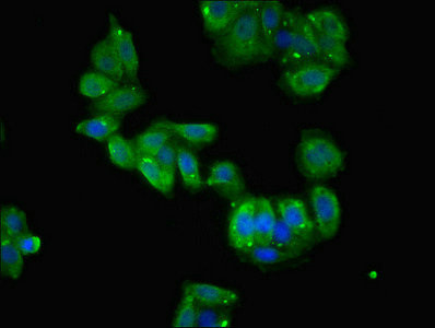 TCTE1 Antibody in Immunocytochemistry (ICC/IF)