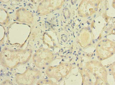 TCTE1 Antibody in Immunohistochemistry (Paraffin) (IHC (P))