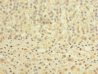 TCTE1 Antibody in Immunohistochemistry (Paraffin) (IHC (P))