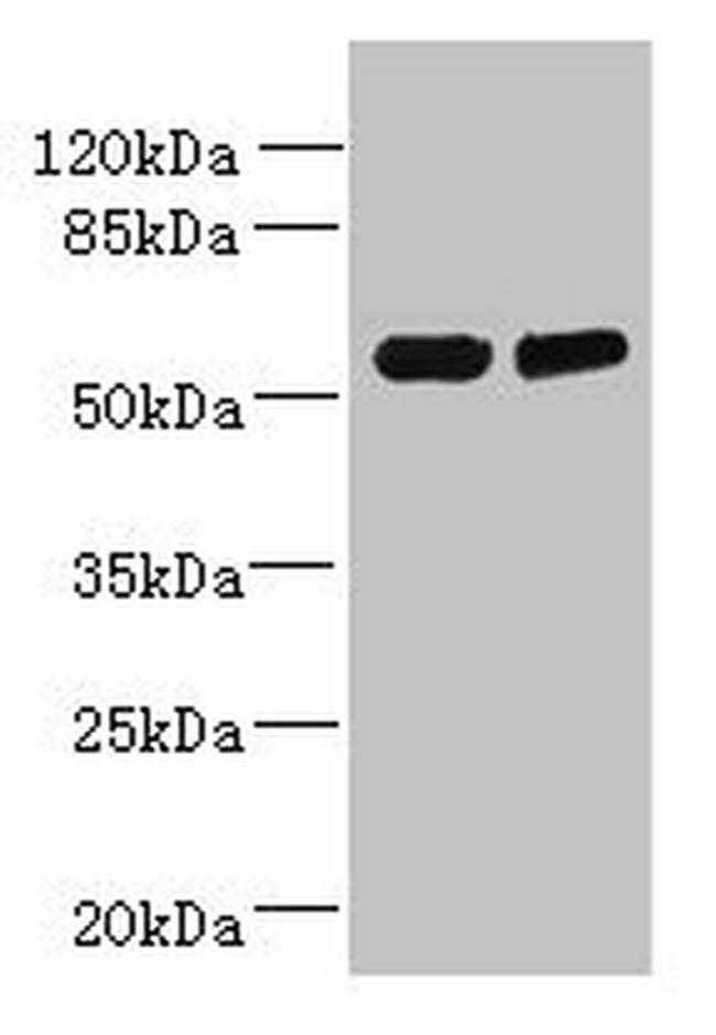 TCTE1 Antibody in Western Blot (WB)