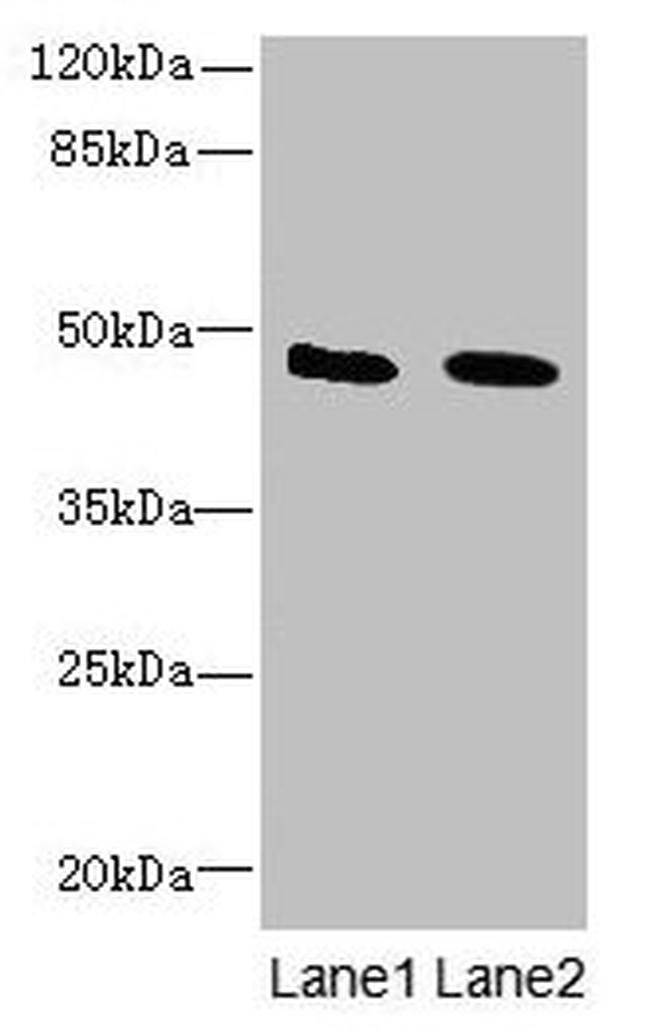 IGSF11 Antibody in Western Blot (WB)