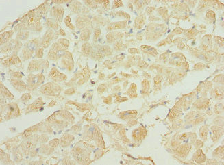 TNNI3K Antibody in Immunohistochemistry (Paraffin) (IHC (P))