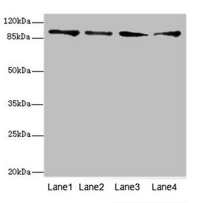 TNNI3K Antibody in Western Blot (WB)