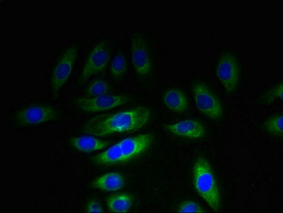 KHDC1 Antibody in Immunocytochemistry (ICC/IF)