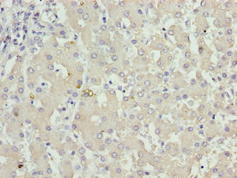 KHDC1 Antibody in Immunohistochemistry (Paraffin) (IHC (P))