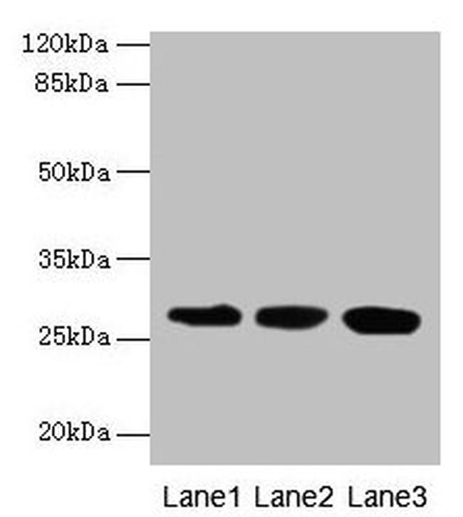 KHDC1 Antibody in Western Blot (WB)