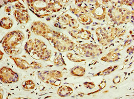 ACSM3 Antibody in Immunohistochemistry (Paraffin) (IHC (P))