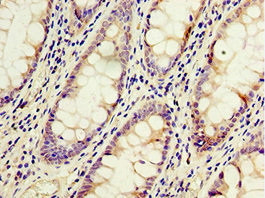 ACSM3 Antibody in Immunohistochemistry (Paraffin) (IHC (P))