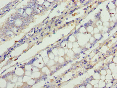 C1orf101 Antibody in Immunohistochemistry (Paraffin) (IHC (P))