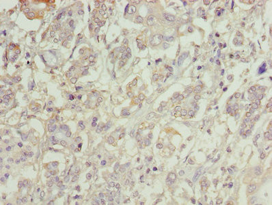 C1orf101 Antibody in Immunohistochemistry (Paraffin) (IHC (P))