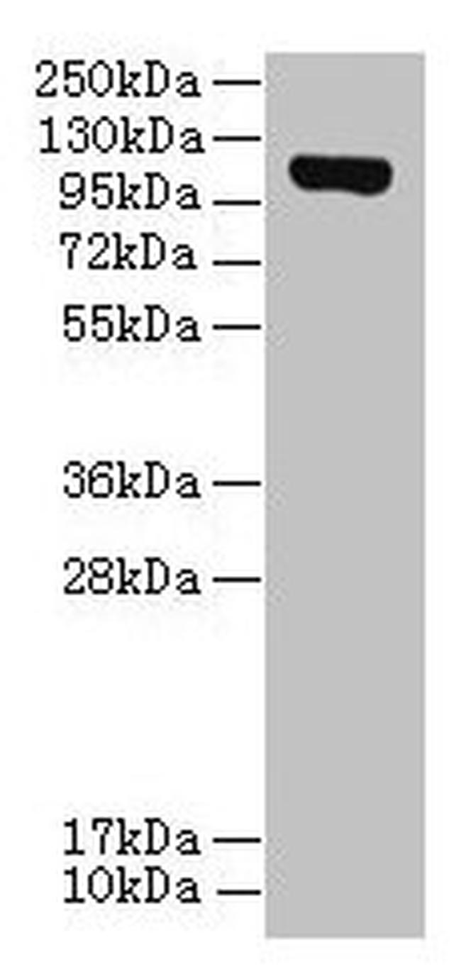 DENND2C Antibody in Western Blot (WB)