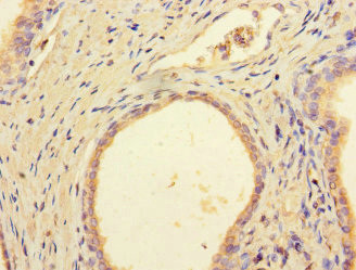 DCAF8 Antibody in Immunohistochemistry (Paraffin) (IHC (P))