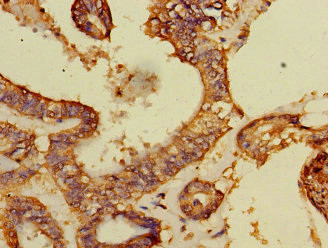 DCAF8 Antibody in Immunohistochemistry (Paraffin) (IHC (P))