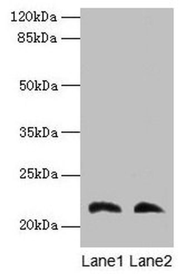 LGALS9C Antibody in Western Blot (WB)