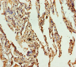 SLC34A1 Antibody in Immunohistochemistry (Paraffin) (IHC (P))