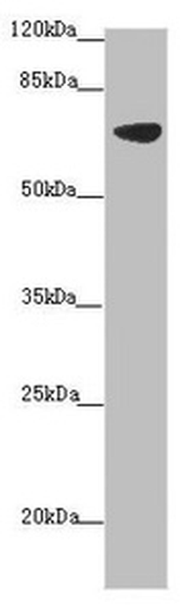 SLC34A1 Antibody in Western Blot (WB)