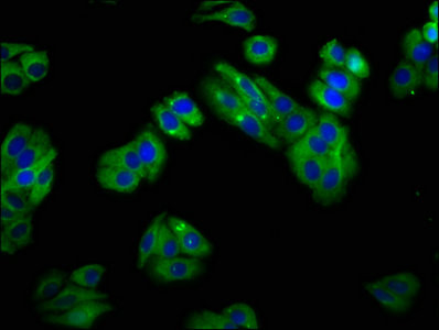 SLC22A25 Antibody in Immunocytochemistry (ICC/IF)