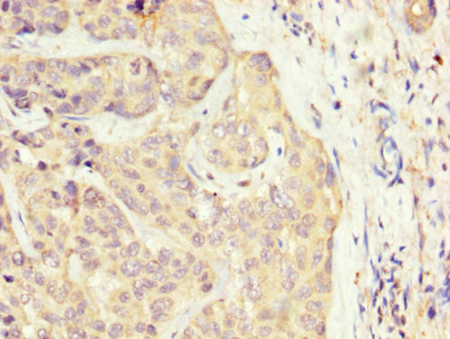 SLC22A25 Antibody in Immunohistochemistry (Paraffin) (IHC (P))